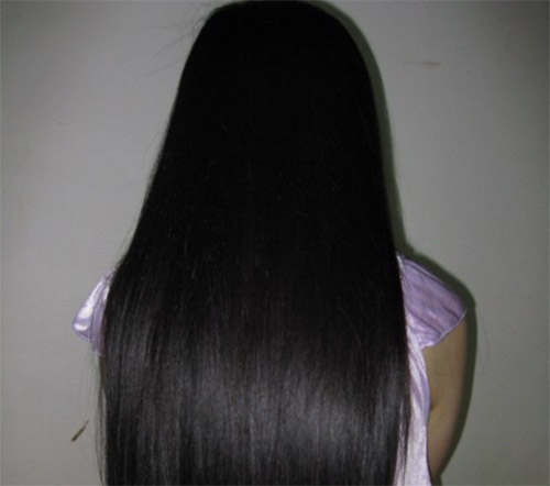 头发里的白色颗粒是脂溢性脱发吗,头痒抠出的黄泥是什么