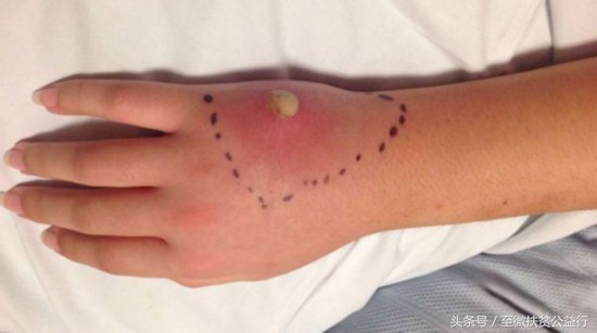 农村动物界的“四大天王”！招惹它们定会让你痛不欲生！