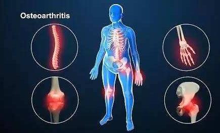 全国最好的治骨关节炎的医院,关节炎医院十大排名