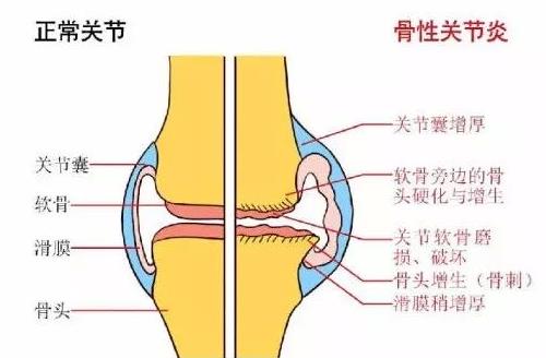 全国最好的治骨关节炎的医院,关节炎医院十大排名
