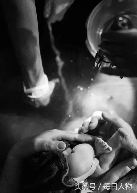 无痛分娩为何普及率不高,现在无痛分娩普遍吗