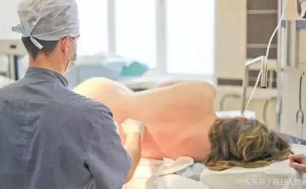 无痛分娩为何普及率不高,现在无痛分娩普遍吗