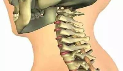 转动脖子咔咔响怎么锻炼,转脖子咔咔响手法