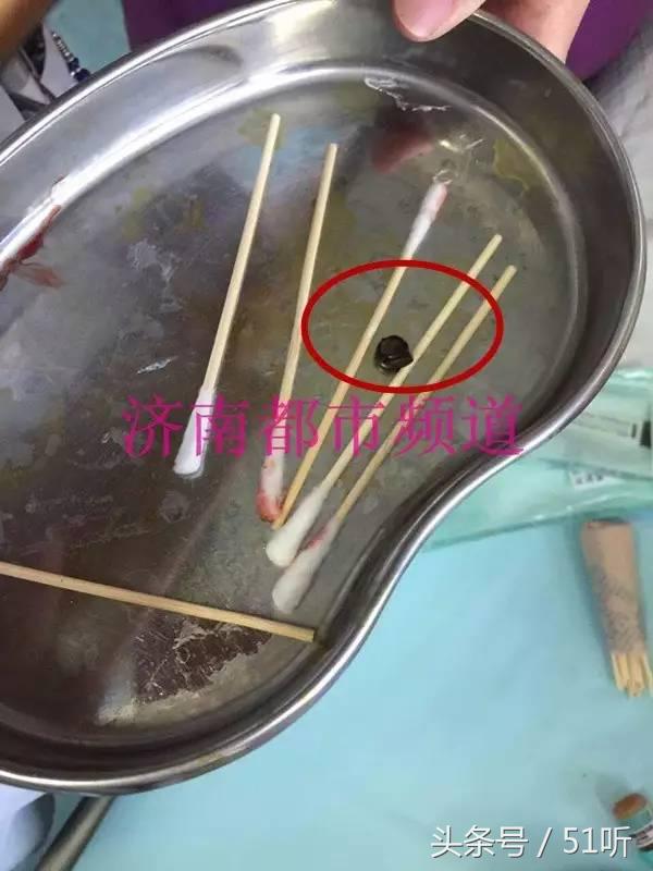 小孩误吞橡皮泥有伤害吗,一岁婴儿误食橡皮泥该如何处理