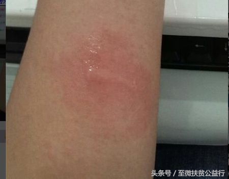 农村动物界的“四大天王”！招惹它们定会让你痛不欲生！