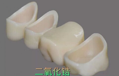 真正的烤瓷牙,烤瓷牙的真实感