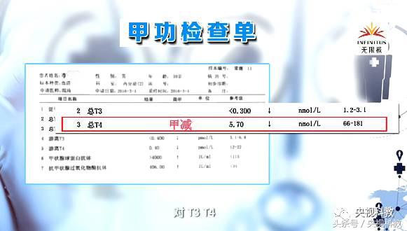 健康之路甲减,一张图自测是否有甲减