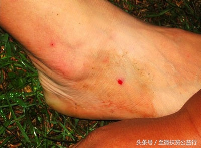 农村动物界的“四大天王”！招惹它们定会让你痛不欲生！