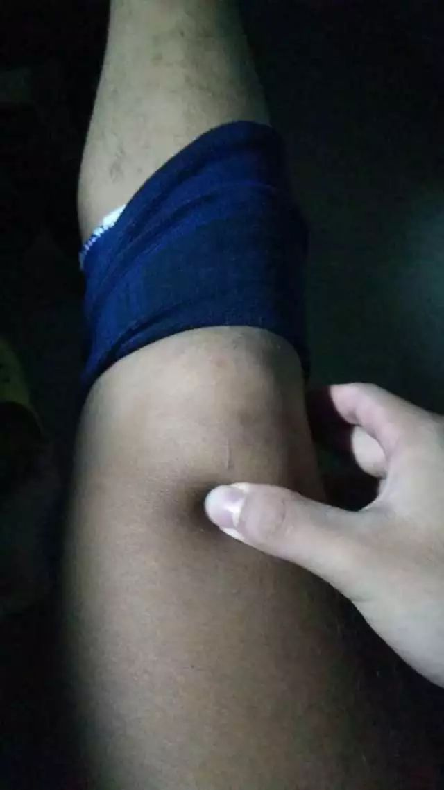 网球肘的最佳打法,如何发力避免网球肘