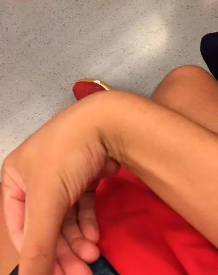 网球肘的最佳打法,如何发力避免网球肘