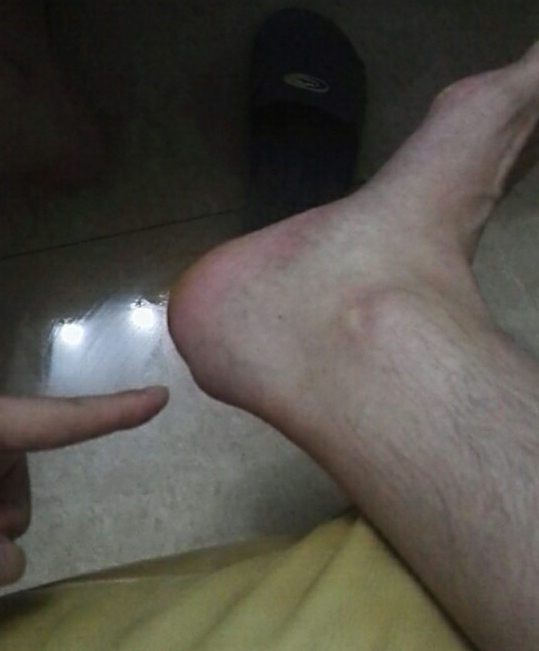 网球肘的最佳打法,如何发力避免网球肘