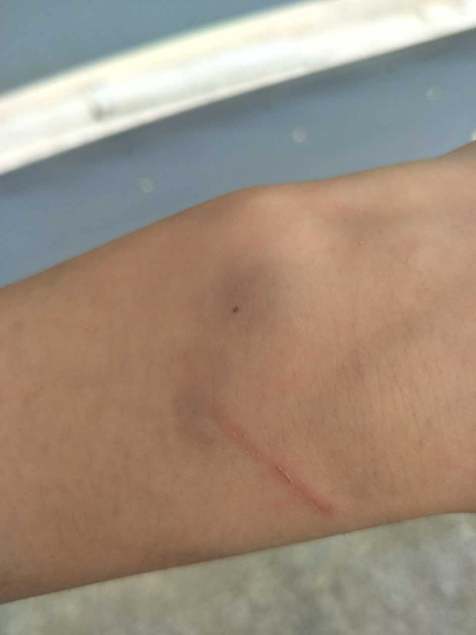 婆婆老是动手打媳妇怎么办,婆婆动手打儿媳该原谅吗