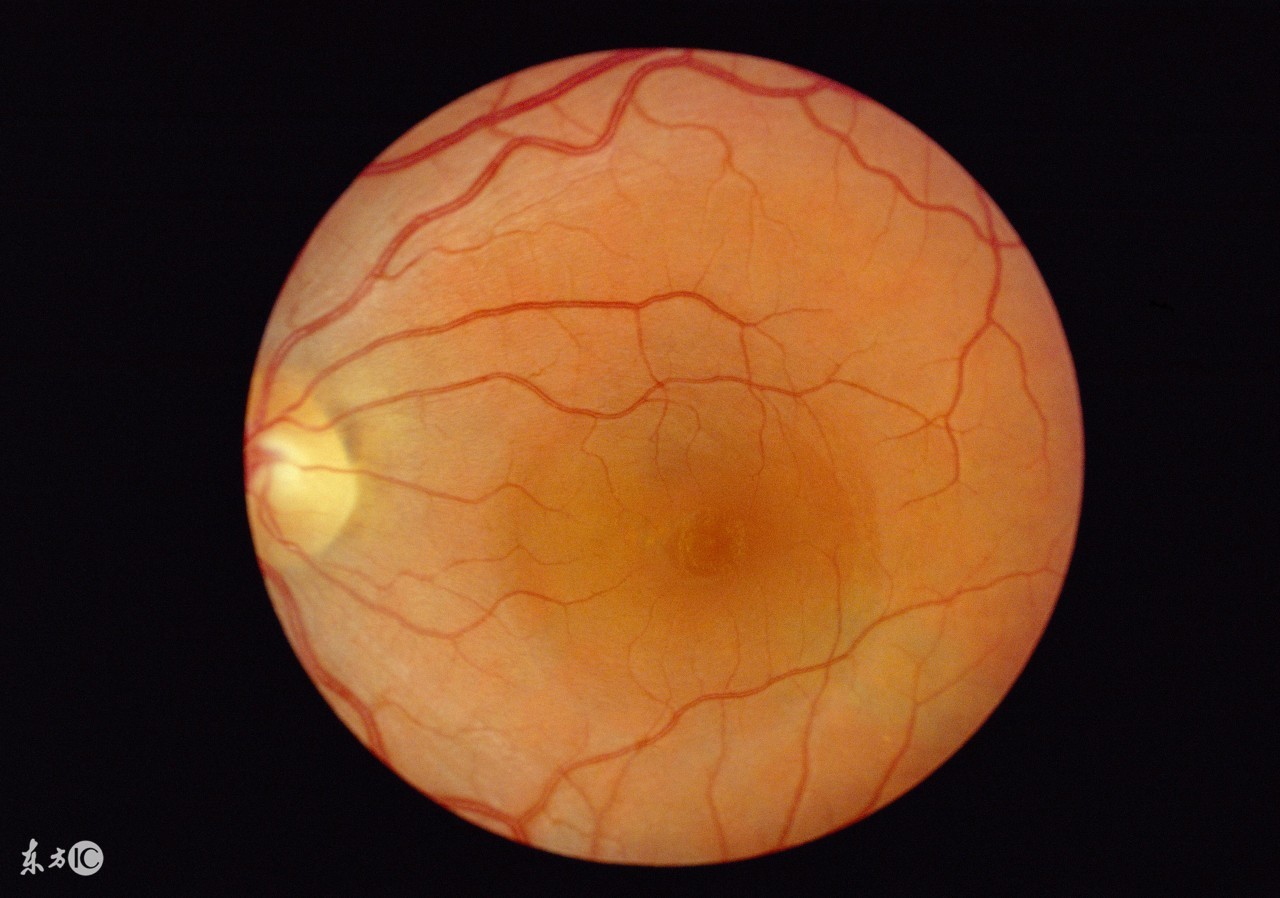 尿毒症透析皮肤瘙痒怎么办,尿毒症早期症状