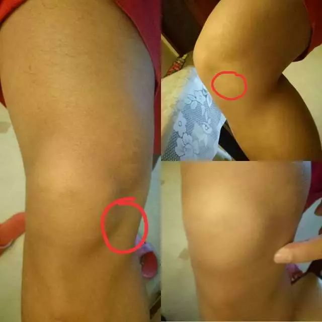 网球肘的最佳打法,如何发力避免网球肘