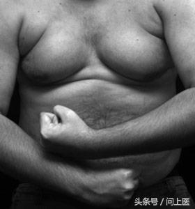 高能预警！图解13种不同寻常的药物副作用