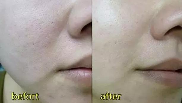 便宜又实惠好用的面膜,平价又实惠面膜