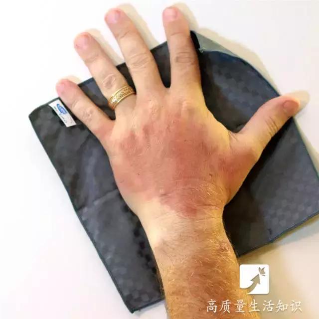 被开水烫伤紧急处理方法,不慎被开水烫伤急救方法