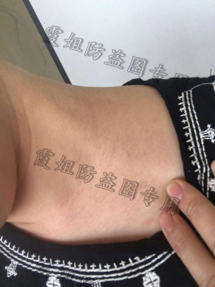 扁平疣｜快去点掉你的扁平疣，别传染给我