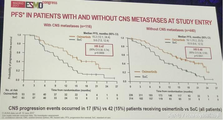 欧洲肿瘤大会最新消息,欧洲肿瘤大会最新报道肺癌