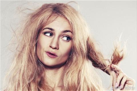 遗传性脱发适合种植头发吗,遗传性脱发搞什么发型