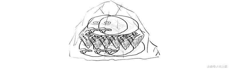 为什么痛风都在脚趾头,痛风形成过程漫画