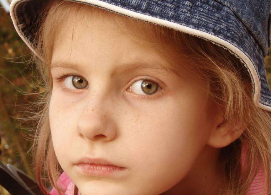 鼻梁黑色素沉积怎么办,鼻梁两侧黑色素沉积怎么遮