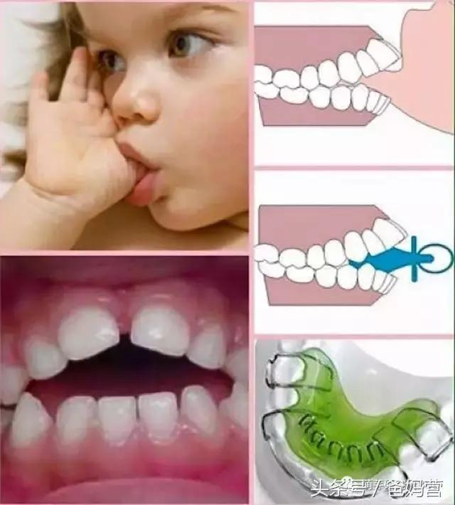 有一种瘾，叫“吃手”：如何戒掉孩子吃手的毛病？