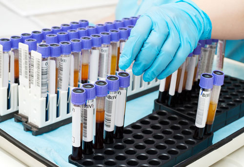 干细胞创新发明,走进神奇的干细胞移植