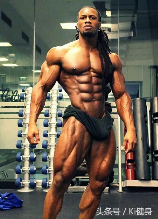 腹直肌上部分离,腹直肌及腹直肌分离