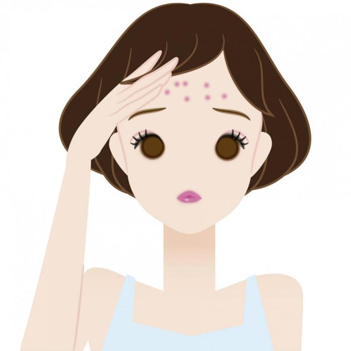 下巴和脸颊两腮长痘中医怎么调理,脸颊两边反复长痘怎么解决老中医