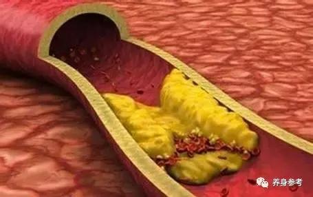 白发与血管血液的关系,白发多应该增加哪些营养补充