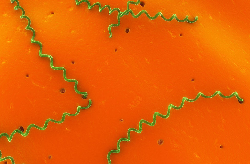 瀹犵墿鍠濅笉骞插噣鐨勬按鐢熺梾,瀹犵墿涔辨媺灞庡翱鎬庝箞瑙e喅