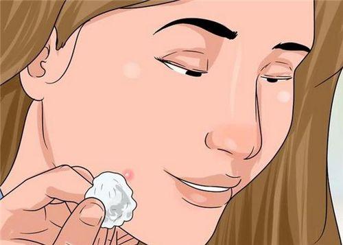 如何彻底告别痘痘成人痘,有一种痘很大个是红色的