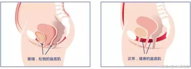 盆底肌大揭秘:你的*福性**她知道!