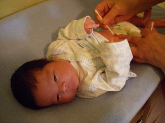 宝宝脐带刚掉脐窝是怎样的,一个多月婴儿脐带有黄水