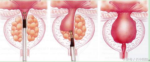 男人到了30岁还有病吗,男人得了这三种病