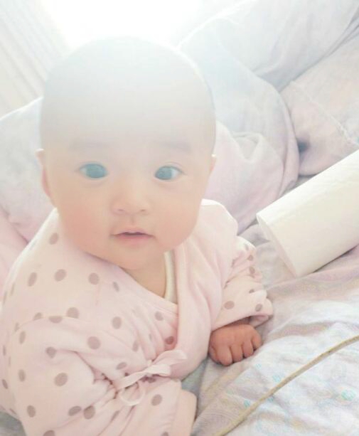 宝宝的拇指内扣怎么回事,宝宝三个半月大拇指内扣怎么办