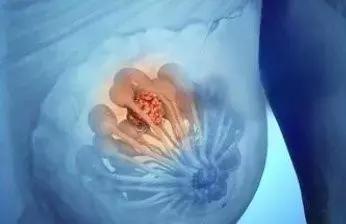 女性常见妇科病的4种解决方法,8种妇科病还在治不要再上当了