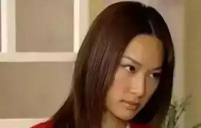 张歆艺打了玻尿酸后的样子,张歆艺下巴打了玻尿酸