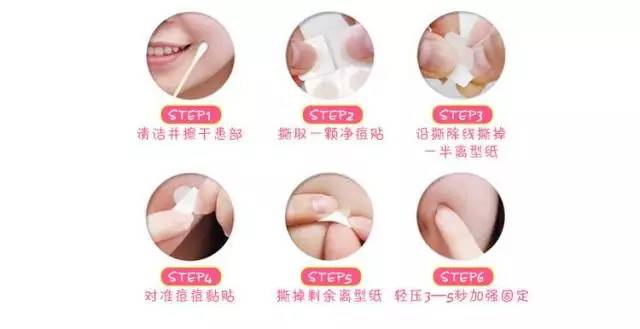 自己在家怎么正确挤痘痘,教你如何挤痘