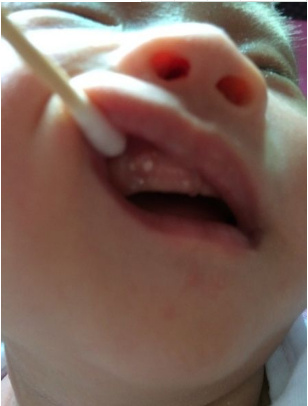 宝宝这几种异常原来不是病,宝宝这些异常行为说明宝宝聪明