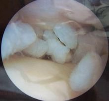 腿软啥问题,腿软无力是大病前兆