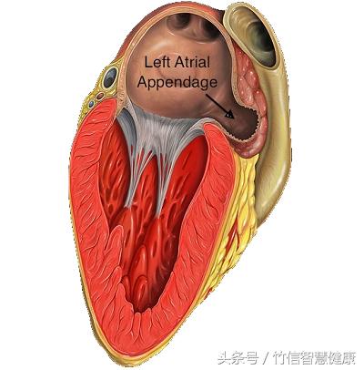 房颤患者属于慢性病吗,房颤究竟是怎么得的