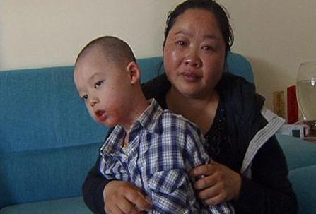 湿疹溃烂流水可以用激素类药膏吗,婴儿湿疹不好可以一直用激素药吗