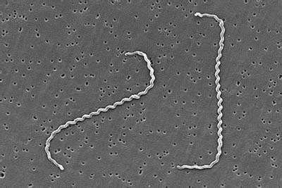 瀹犵墿鍠濅笉骞插噣鐨勬按鐢熺梾,瀹犵墿涔辨媺灞庡翱鎬庝箞瑙e喅