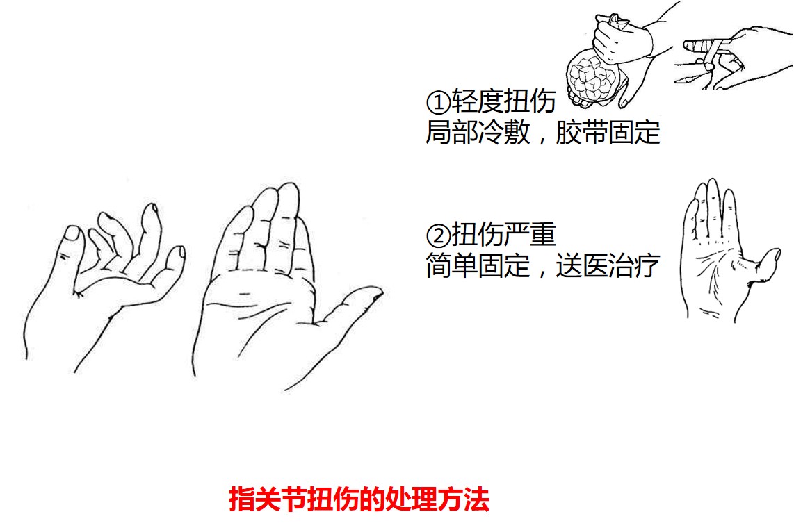 常见运动损伤及处理方法教案,怎样处理运动锻炼中常见的损伤