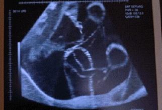 什么时候能“看”到胎动?不同月份胎动有不同感觉