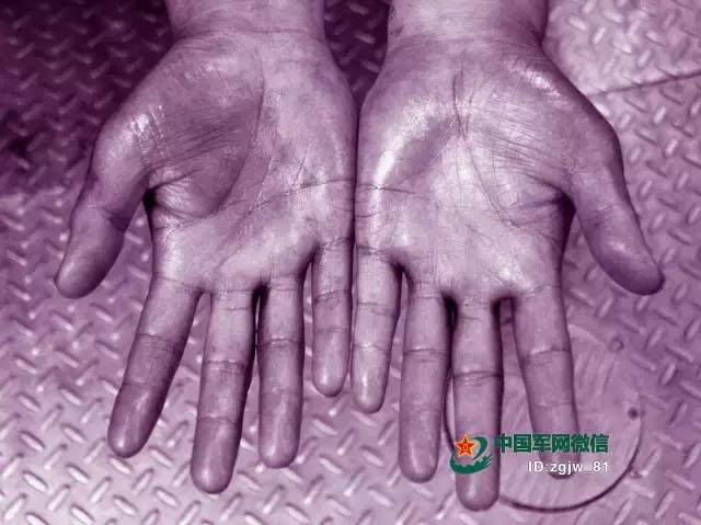 心脏守护神舰艇,军舰心脏守护者