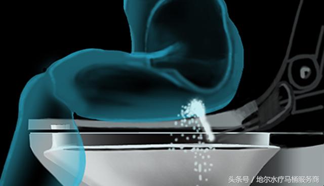 孕妇得了痔疮生活中需要注意什么,得了血栓性痔疮应该注意什么