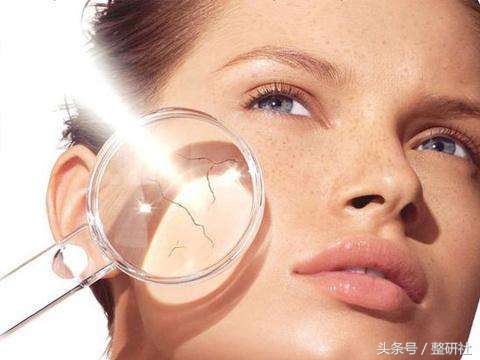 光电祛疤效果图,光电祛斑拯救麻子脸